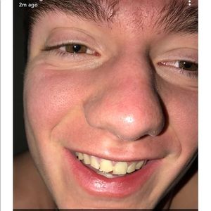 Meet your Posher, Dante